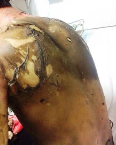 הצתה מאוחרת